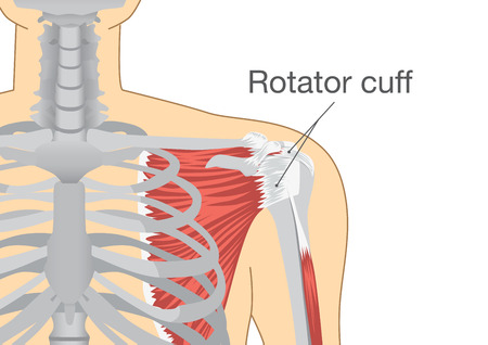 The Effectiveness of PRP for Treating Rotator Cuff Tendinopathy ...